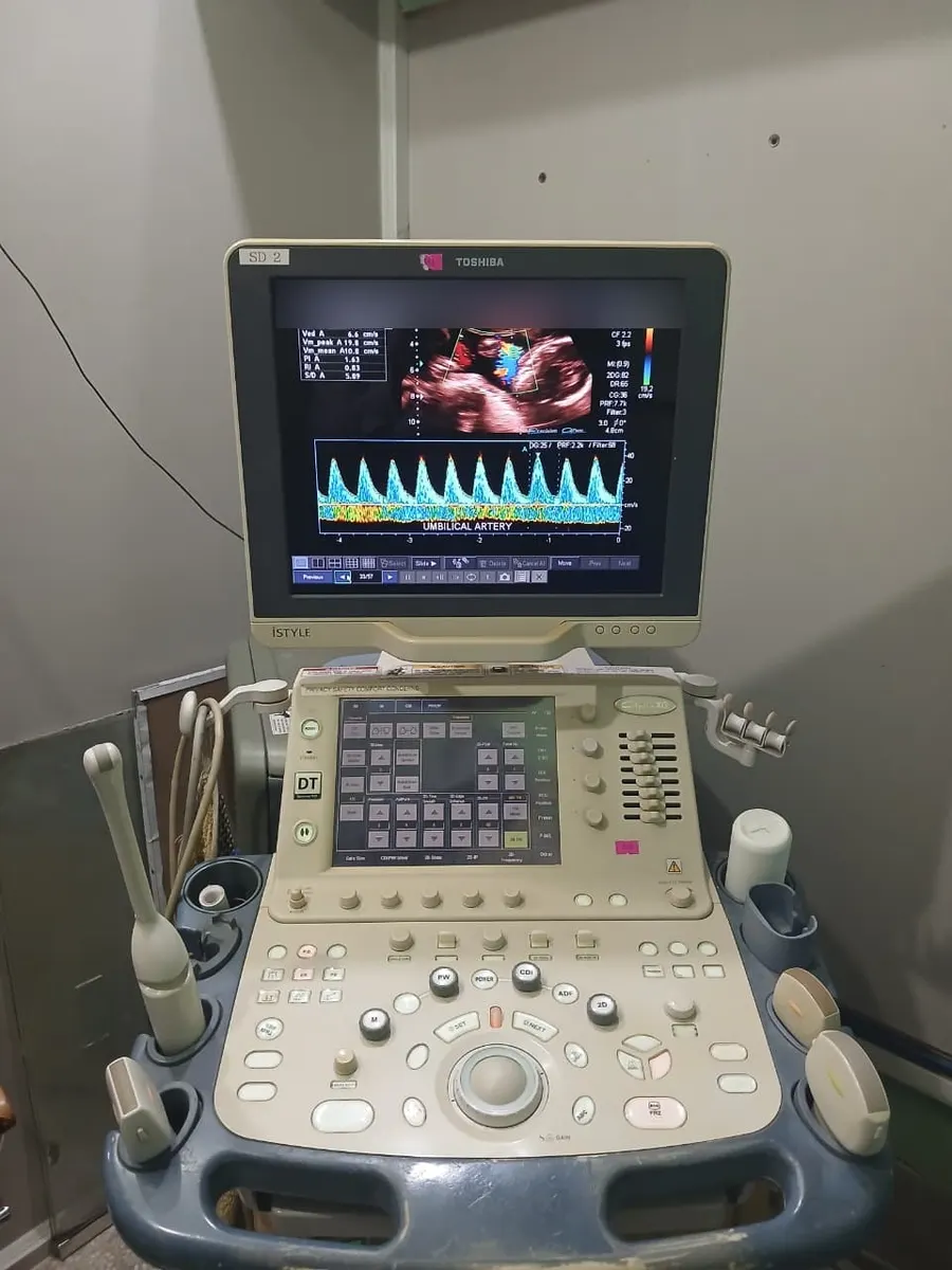Our Toshiba ultrasound machine showing a colour Doppler scan